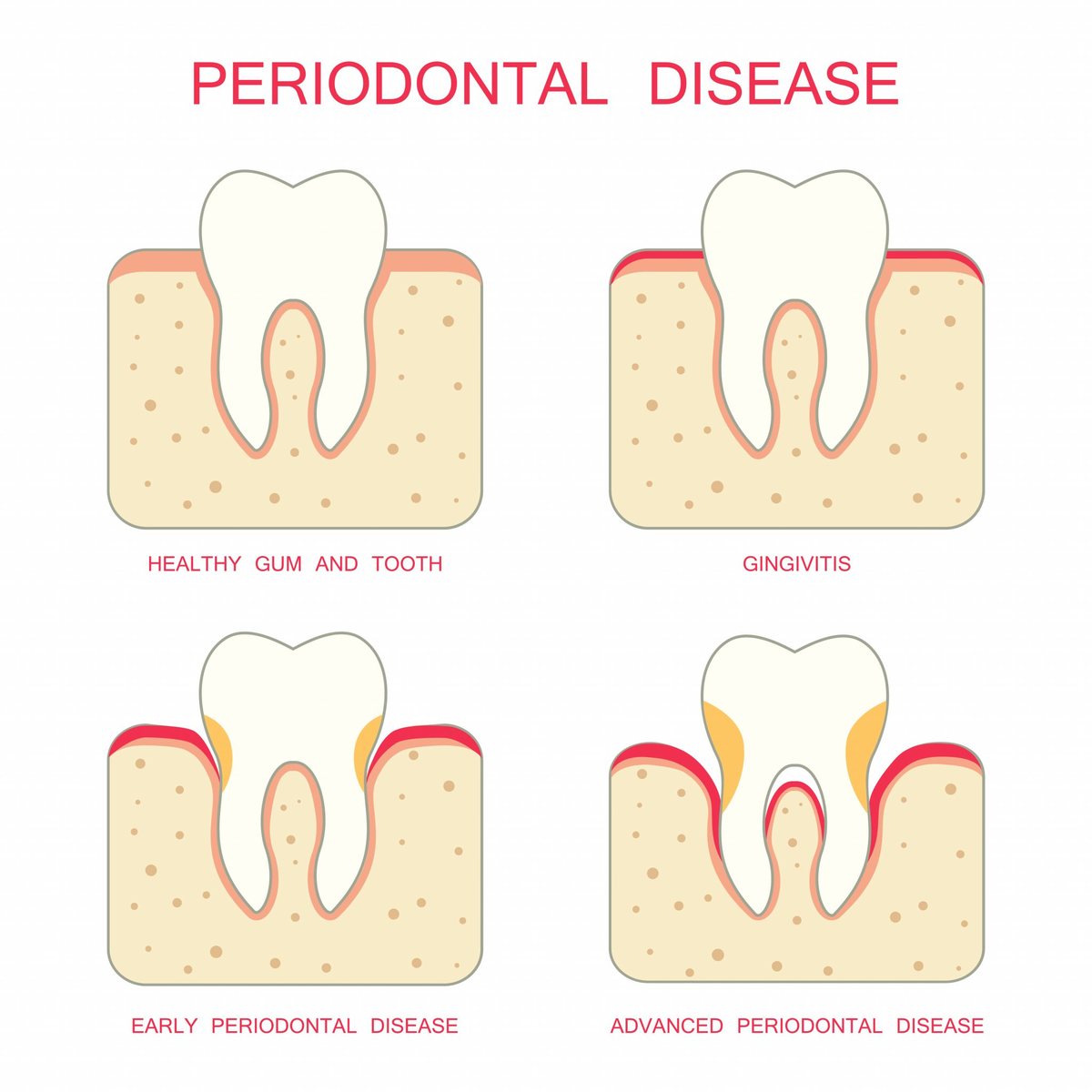 Illustration des tissus qui entourent et supportent les dents